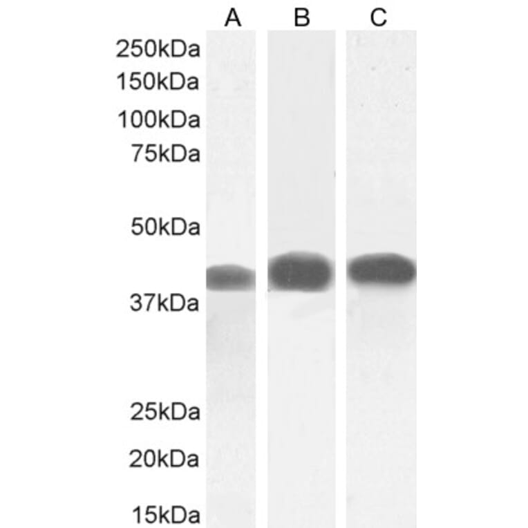 Western Blot - Anti-ACAT1 Antibody (A84741) - Antibodies.com