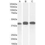 Western Blot - Anti-ACAT1 Antibody (A84741) - Antibodies.com