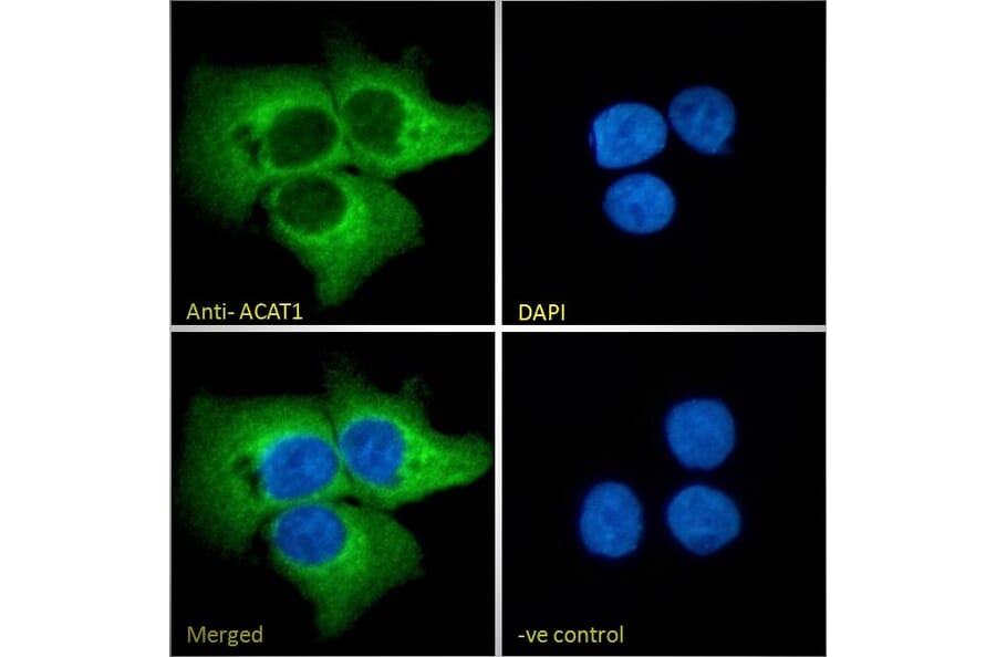 Immunofluorescence - Anti-ACAT1 Antibody (A84741) - Antibodies.com