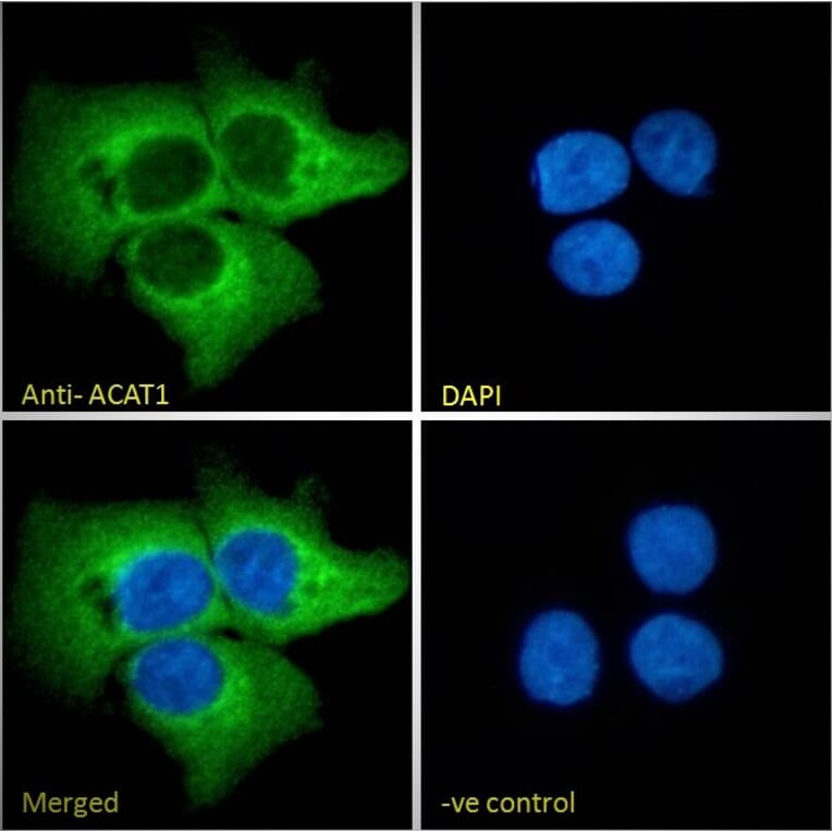 Immunofluorescence - Anti-ACAT1 Antibody (A84741) - Antibodies.com