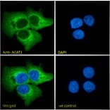 Immunofluorescence - Anti-ACAT1 Antibody (A84741) - Antibodies.com
