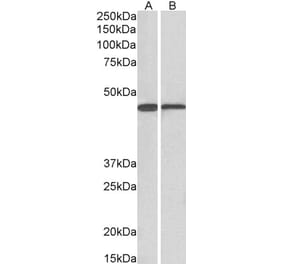 Western Blot - Anti-ACAT1 Antibody (A84741) - Antibodies.com