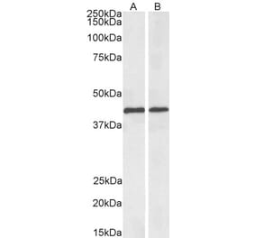 Western Blot - Anti-ACAT1 Antibody (Biotin) (A84742) - Antibodies.com