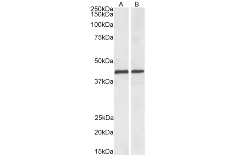 Western Blot - Anti-ACAT1 Antibody (Biotin) (A84742) - Antibodies.com