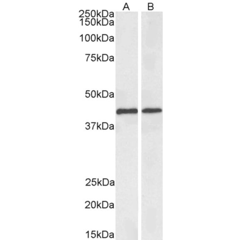 Western Blot - Anti-ACAT1 Antibody (Biotin) (A84742) - Antibodies.com