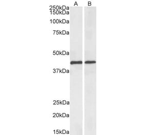 Western Blot - Anti-ACAT1 Antibody (A84742) - Antibodies.com