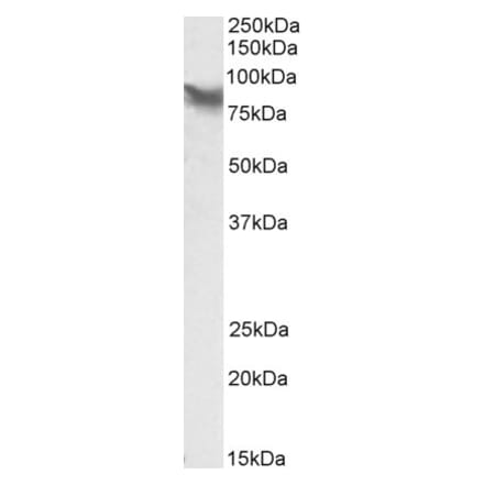 Western Blot - Anti-LPP Antibody (A84745) - Antibodies.com