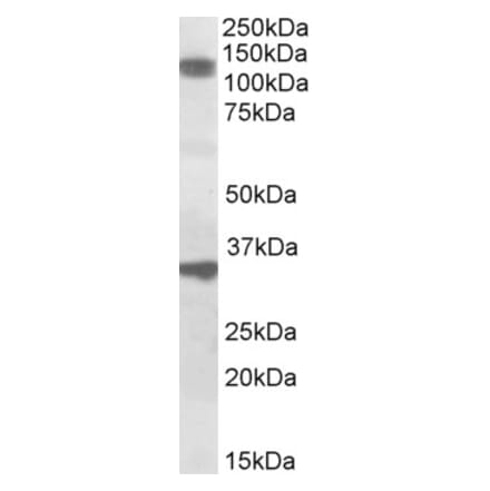 Western Blot - Anti-DIS Antibody (A84746) - Antibodies.com