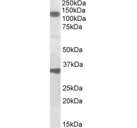 Western Blot - Anti-CCAR1 Antibody (A84746) - Antibodies.com