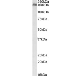 Western Blot - Anti-CSMD1 Antibody (A84747) - Antibodies.com