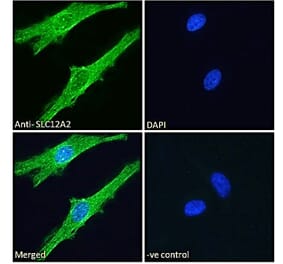 Immunofluorescence - Anti-NKCC1 Antibody (A84750) - Antibodies.com