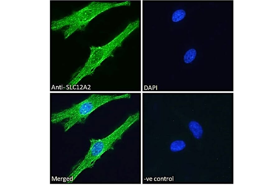 Immunofluorescence - Anti-NKCC1 Antibody (A84750) - Antibodies.com