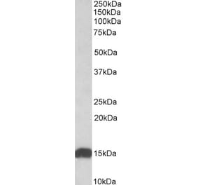 Western Blot - Anti-NDUFS6 Antibody (A84752) - Antibodies.com