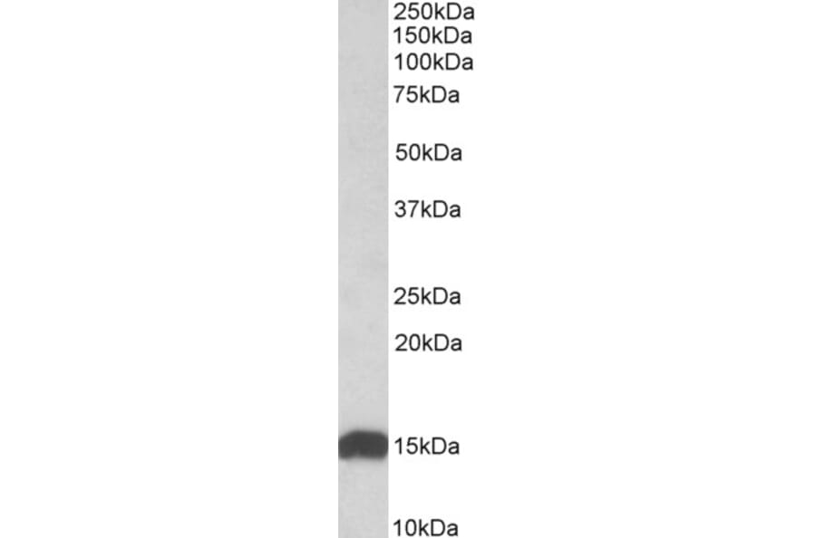 Western Blot - Anti-NDUFS6 Antibody (A84752) - Antibodies.com