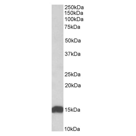 Western Blot - Anti-NDUFS6 Antibody (A84752) - Antibodies.com