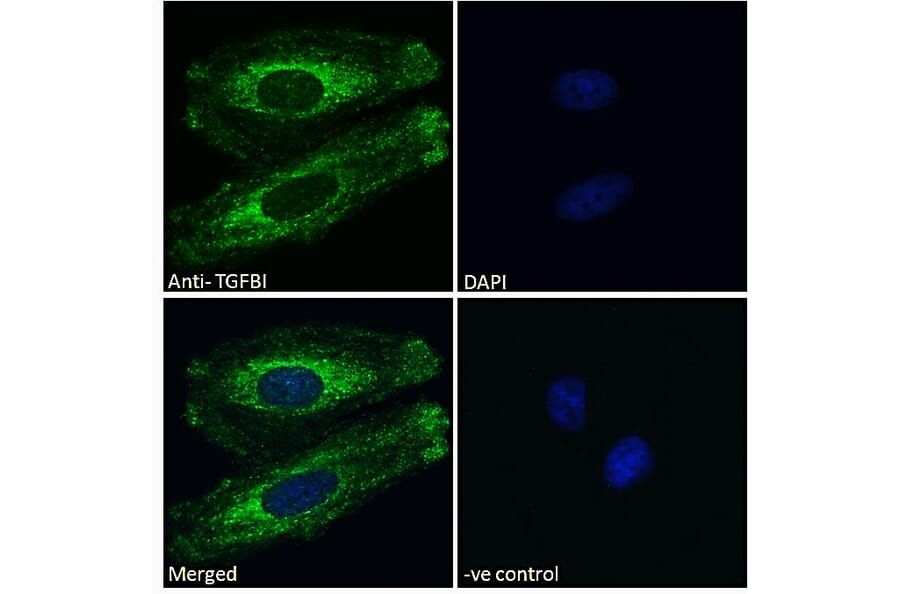 Immunofluorescence - Anti-TGFBI Antibody (A84753) - Antibodies.com