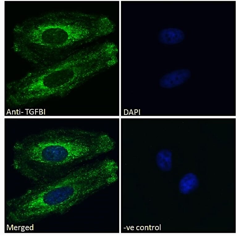 Immunofluorescence - Anti-TGFBI Antibody (A84753) - Antibodies.com