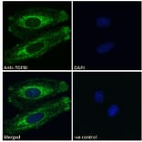 Immunofluorescence - Anti-TGFBI Antibody (A84753) - Antibodies.com