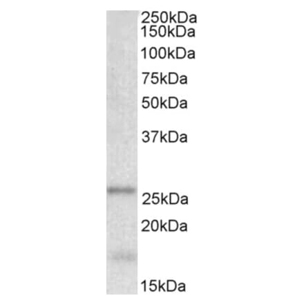 Western Blot - Anti-TPPP Antibody (A84756) - Antibodies.com