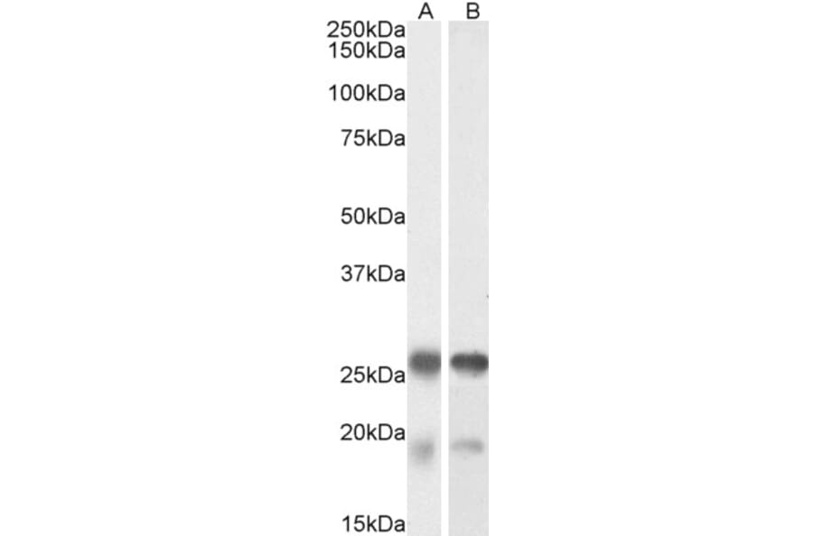 Western Blot - Anti-TPPP Antibody (A84756) - Antibodies.com