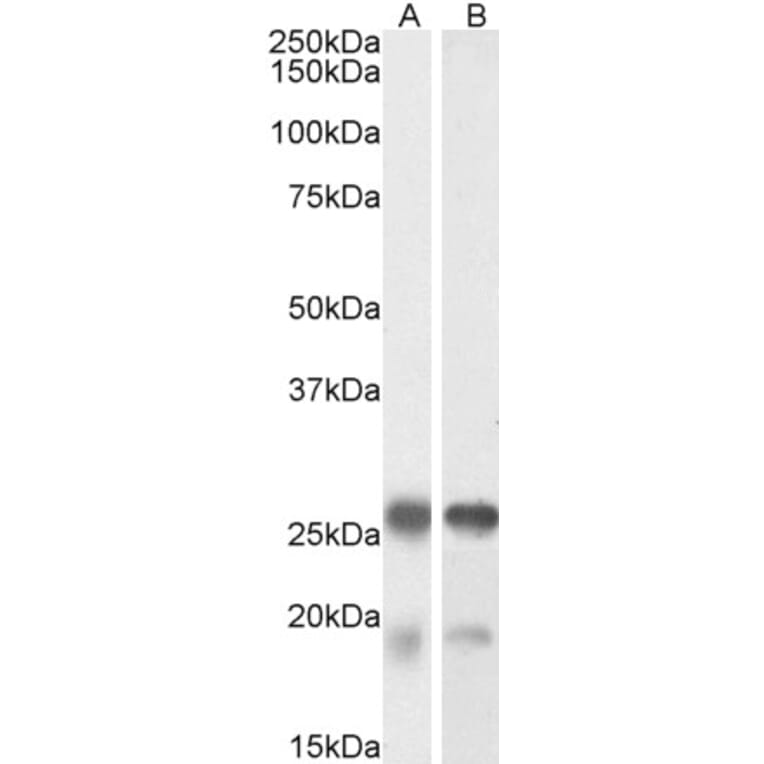 Western Blot - Anti-TPPP Antibody (A84756) - Antibodies.com
