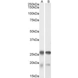 Western Blot - Anti-TPPP Antibody (A84756) - Antibodies.com