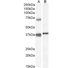 Western Blot - Anti-TRIM29 Antibody (A84758) - Antibodies.com