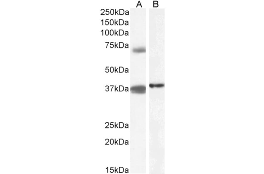 Western Blot - Anti-TRIM29 Antibody (A84758) - Antibodies.com