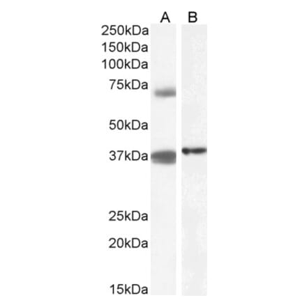 Western Blot - Anti-TRIM29 Antibody (A84758) - Antibodies.com