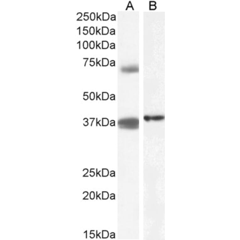 Western Blot - Anti-TRIM29 Antibody (A84758) - Antibodies.com