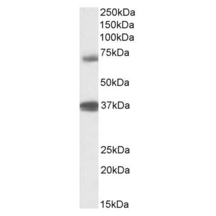 Western Blot - Anti-TRIM29 Antibody (A84758) - Antibodies.com