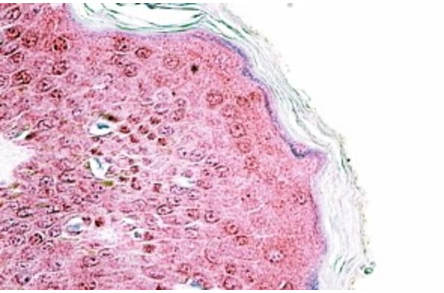 Immunohistochemistry - Anti-TRIM29 Antibody (A84758) - Antibodies.com