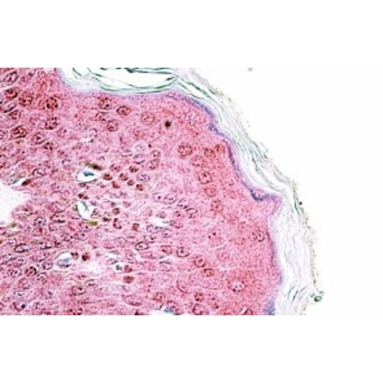 Immunohistochemistry - Anti-TRIM29 Antibody (A84758) - Antibodies.com