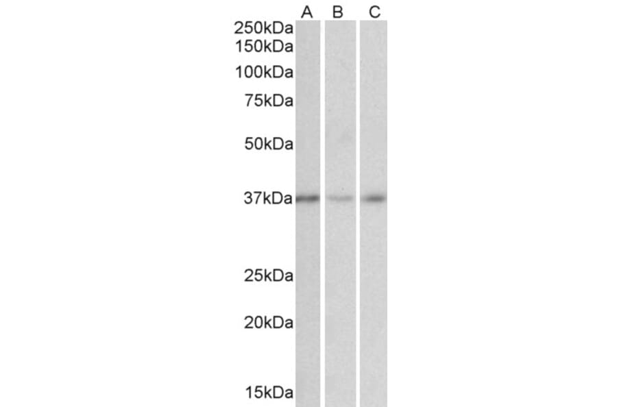 Western Blot - Anti-GHITM (MICS1) Antibody (A84759) - Antibodies.com