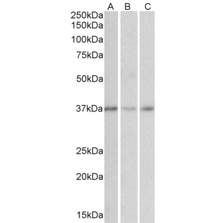 Western Blot - Anti-GHITM (MICS1) Antibody (A84759) - Antibodies.com