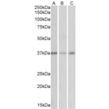 Western Blot - Anti-GHITM (MICS1) Antibody (A84759) - Antibodies.com