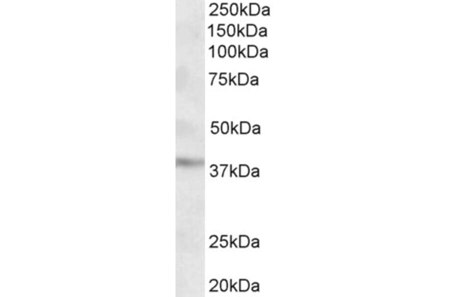 Western Blot - Anti-GHITM (MICS1) Antibody (A84760) - Antibodies.com