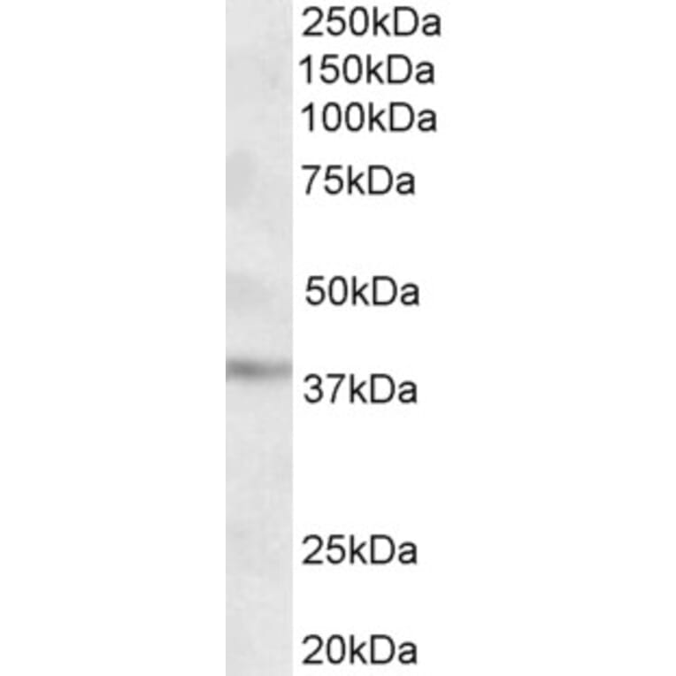 Western Blot - Anti-GHITM (MICS1) Antibody (A84760) - Antibodies.com