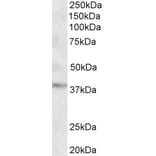 Western Blot - Anti-GHITM (MICS1) Antibody (A84760) - Antibodies.com