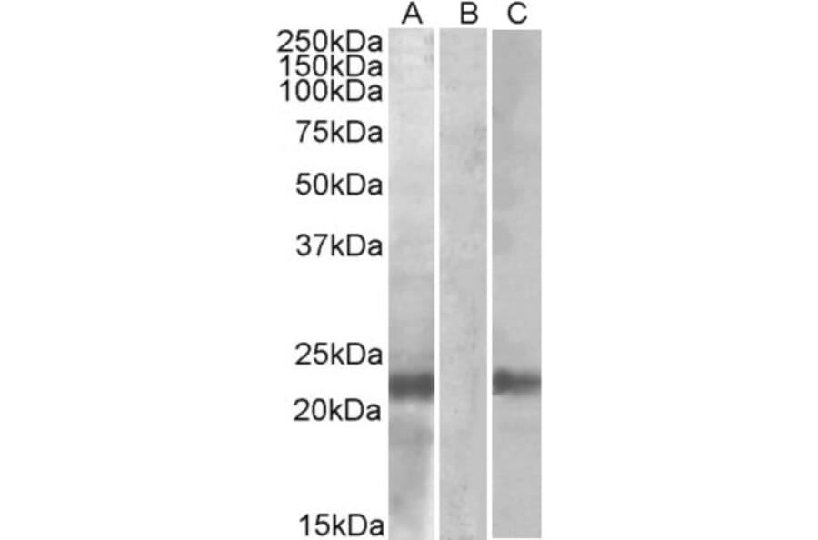 Western Blot - Anti-Cystatin 8 Antibody (A84764) - Antibodies.com