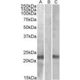 Western Blot - Anti-Cystatin 8 Antibody (A84764) - Antibodies.com
