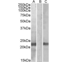 Western Blot - Anti-CST8 Antibody (A84764) - Antibodies.com