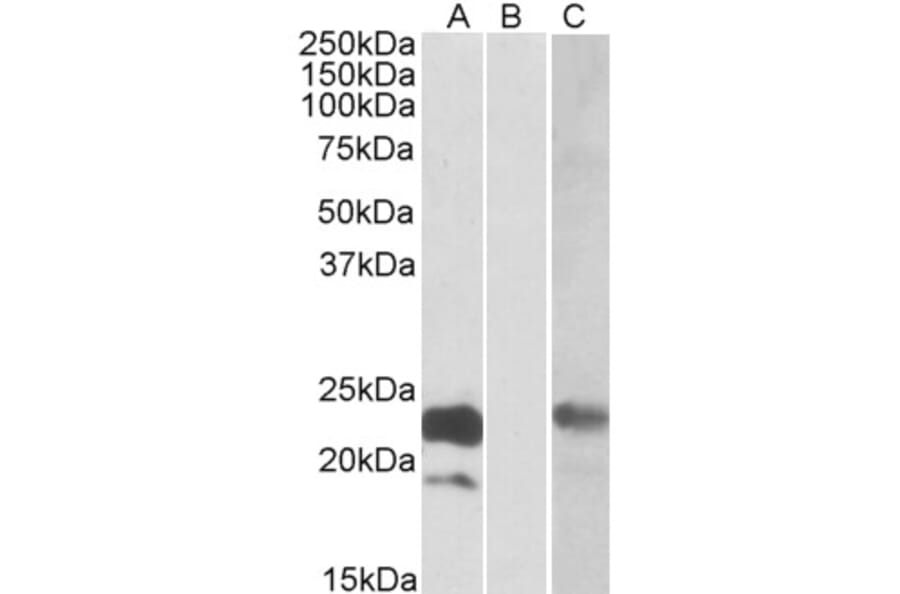 Western Blot - Anti-Cystatin 8 Antibody (A84765) - Antibodies.com