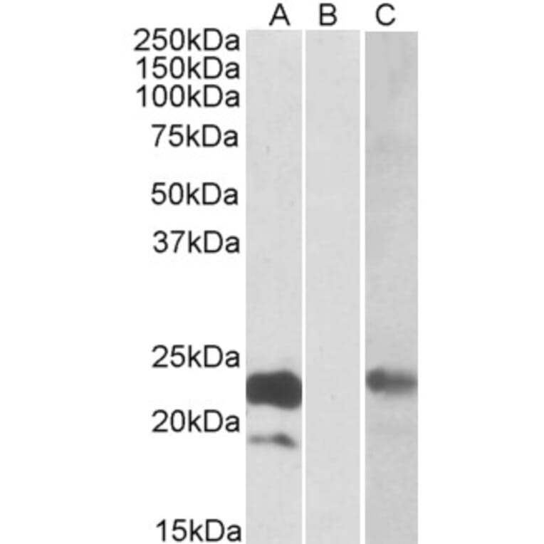 Western Blot - Anti-Cystatin 8 Antibody (A84765) - Antibodies.com
