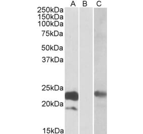 Western Blot - Anti-CST8 Antibody (A84765) - Antibodies.com