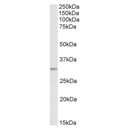 Western Blot - Anti-EB3 Antibody (A84766) - Antibodies.com