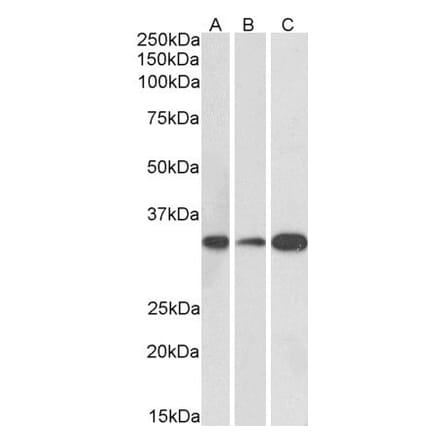 Western Blot - Anti-EB3 Antibody (A84767) - Antibodies.com