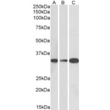 Western Blot - Anti-EB3 Antibody (A84767) - Antibodies.com