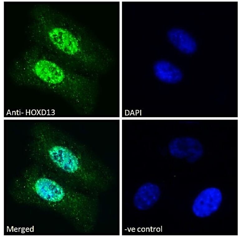 Immunofluorescence - Anti-HOXD13 Antibody (A84770) - Antibodies.com