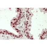 Immunohistochemistry - Anti-HOXD13 Antibody (A84770) - Antibodies.com